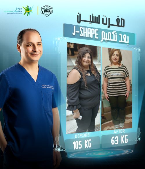 تجربتي مع عملية التكميم
